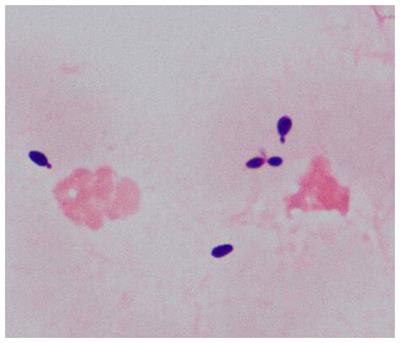 Isolation and identification of Wickerhamiella tropicalis from blood culture by MALDI-MS